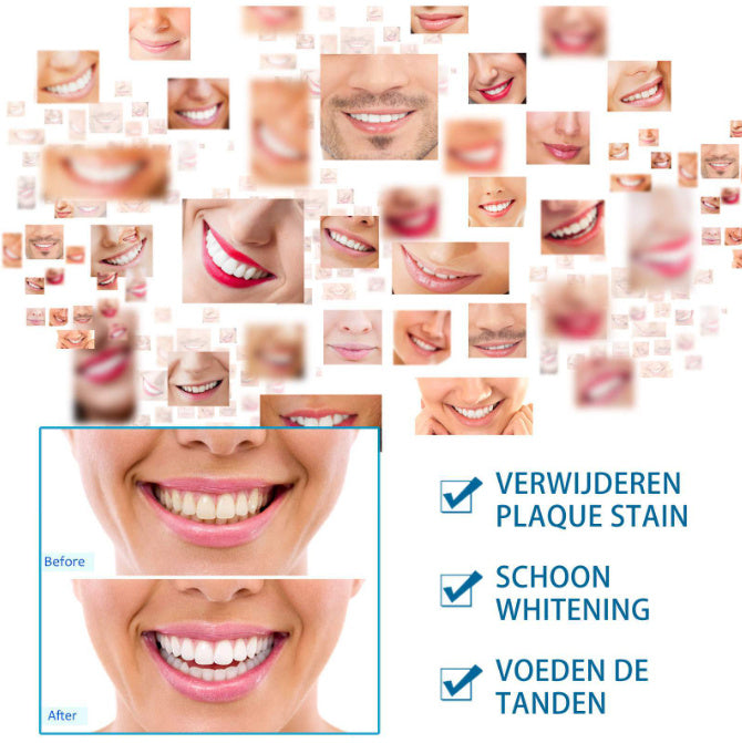 Stylo de blanchiment des dents pour une élimination efficace du jaune